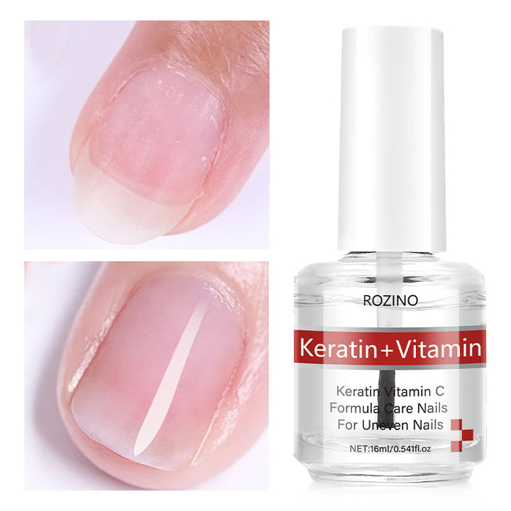 Keratin & Vitamin Nail Care Polish – Peel-Off Nail Strengthener, Quick-Dry, Long-Lasting, Natural Glossy Finish, Whitening Effect