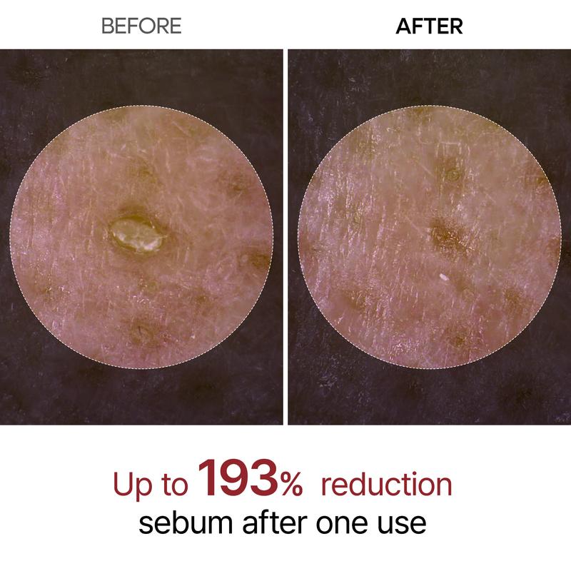 [Dr.Melaxin Official] Peel Shot Glow Rice Ampoule Duo - Serums for Brightening, Exfoliating, and Moisturizing - Suitable for All Skin Types